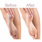 Rechargeable Electric Foot Callus Remover – Pedicure Foot File